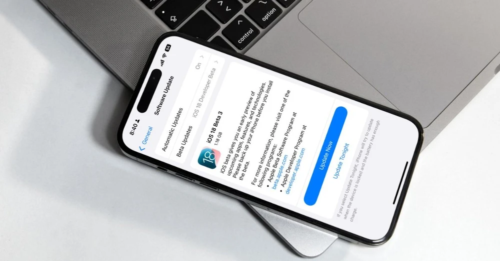 Hướng dẫn cập nhật phần mềm iPhone: Các bước cần làm trước khi update